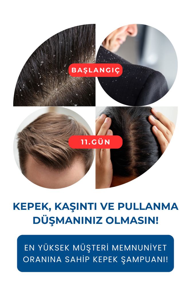 Relief Şampuan 2'li Set - Kaşıntı, Kızarıklık, Pullanma, Kepek Karşıtı