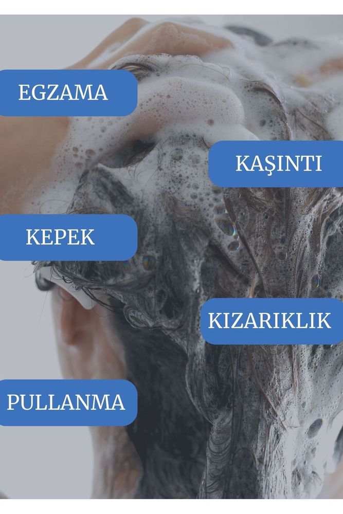 Relief-2 Kepek, Pullanma, Kaşıntı Karşıtı Devam Şampuanı